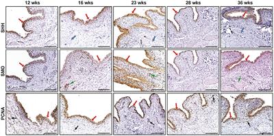 Spatiotemporal Expression of SHH/GLI Signaling in Human Fetal Bladder Development